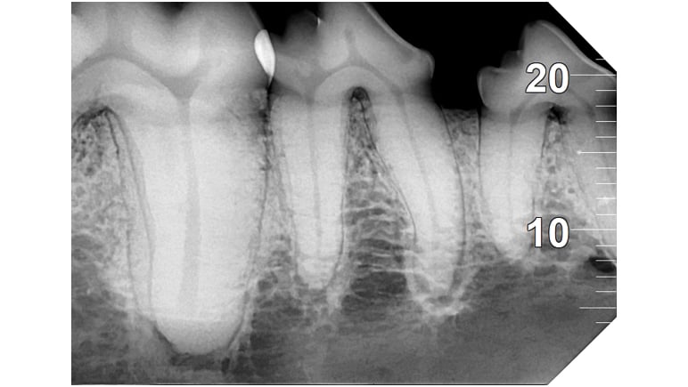 DCIS VET caries revealing_1080x608