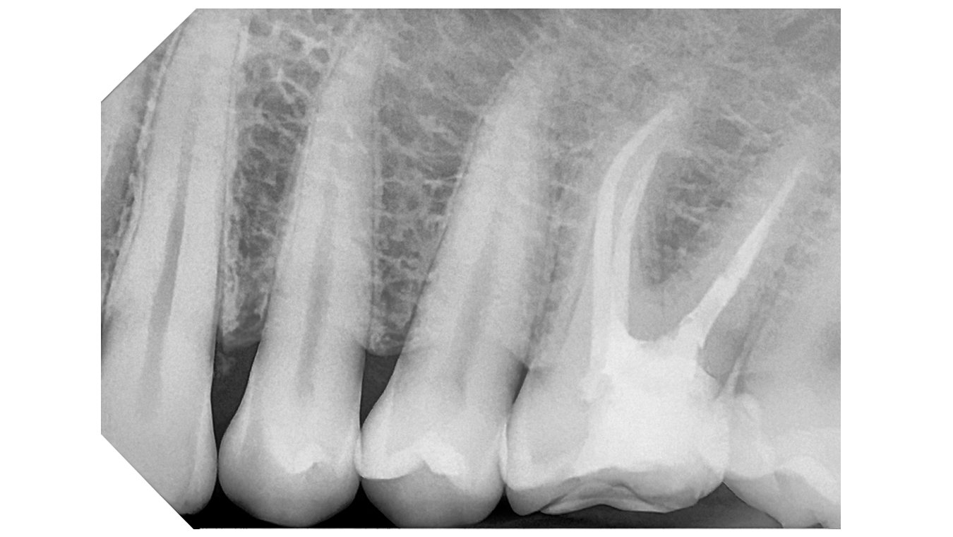 DCIS_HIGH CONTRAST_1080x608