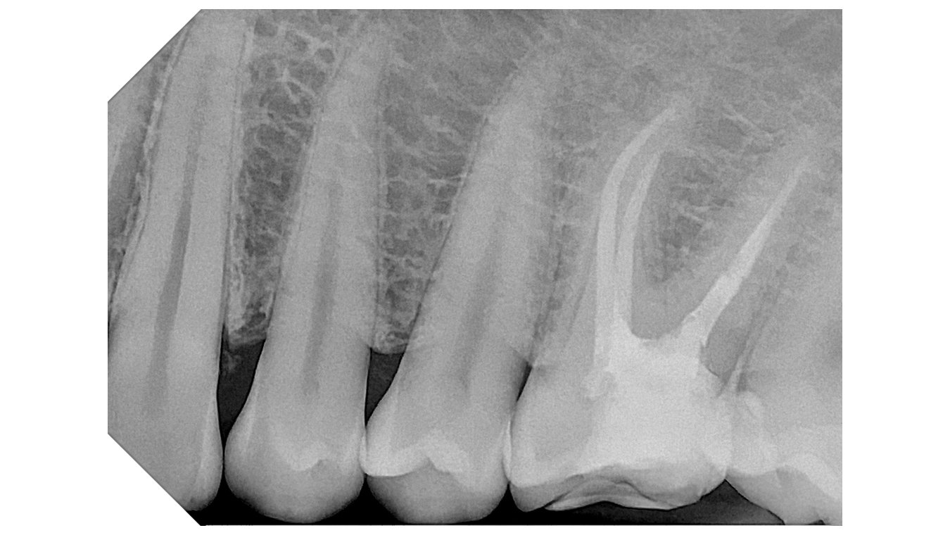 DCIS_HIGH DETAILS_1080x608