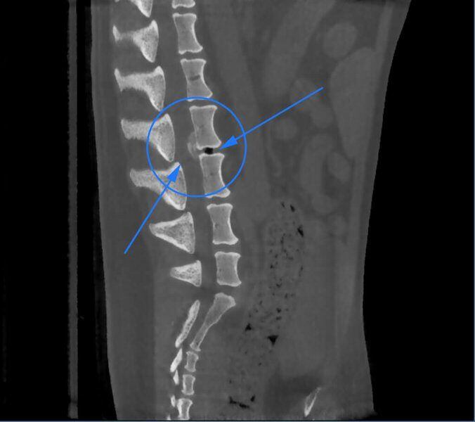 5G XL VET_Immagini Diagnostiche_Ernia del disco lombare_2