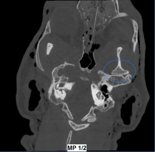 5G XL VET_Immagini Diagnostiche_Lussazione ATM_2