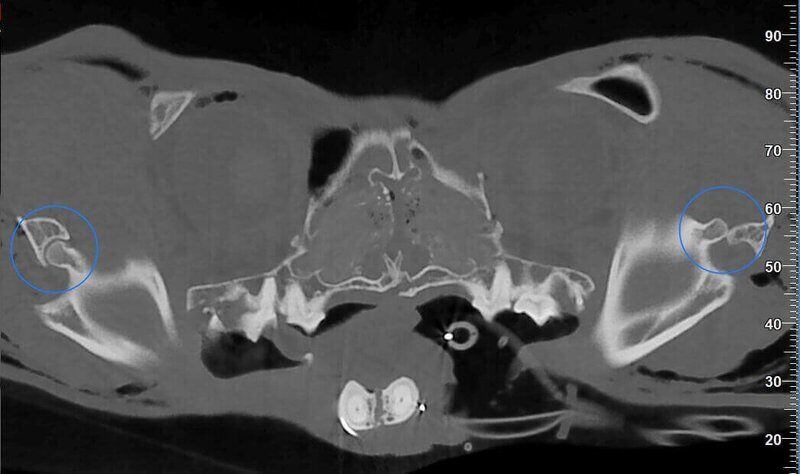 5G XL VET_Immagini Diagnostiche_Lussazione ATM_5