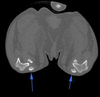 5G XL VET_Immagini Diagnostiche_Lussazione della rotula pre e post-operatoria_1