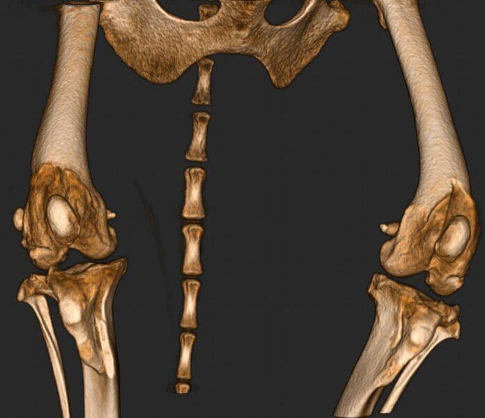 5G XL VET_Immagini Diagnostiche_Lussazione della rotula pre e post-operatoria_5