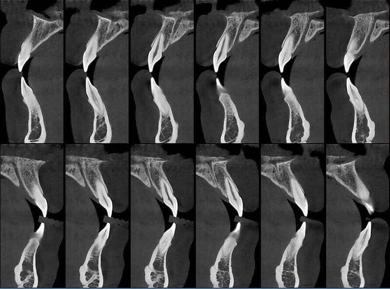 5G XL MED_Immagini Diagnostiche_TESTA E COLLO_DENTIZIONE_Doppia arcata_2