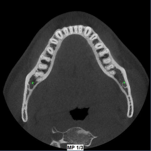 5G XL MED_Immagini Diagnostiche_TESTA E COLLO_DENTIZIONE_Doppia arcata_3