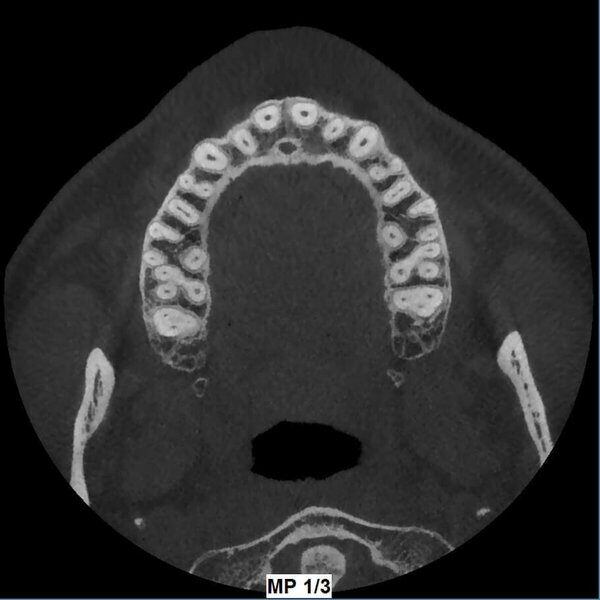 5G XL MED_Immagini Diagnostiche_TESTA E COLLO_DENTIZIONE_Doppia arcata_4