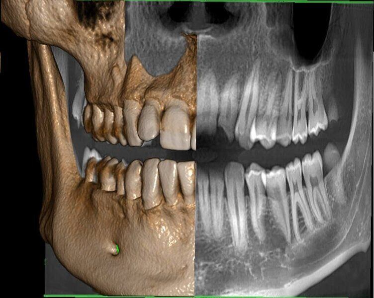 5G XL MED_Immagini Diagnostiche_TESTA E COLLO_DENTIZIONE_Doppia arcata_5
