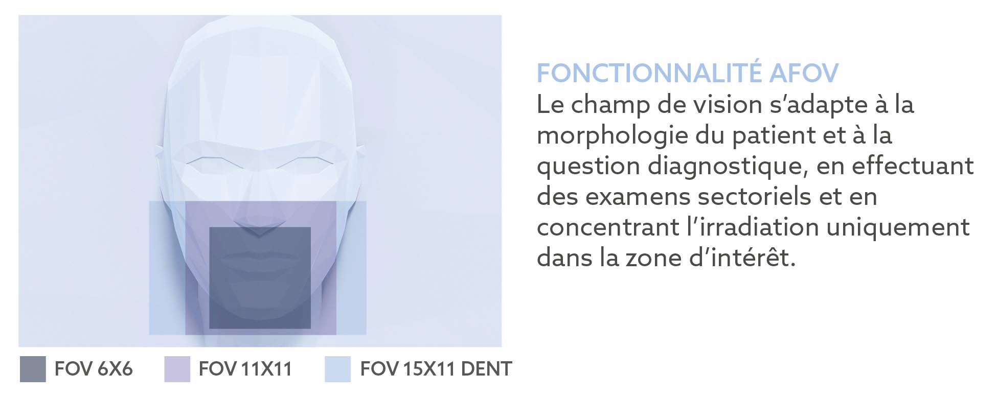 FR FOV VG One