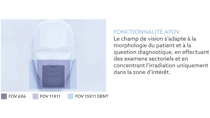 3D VG-One Newtom