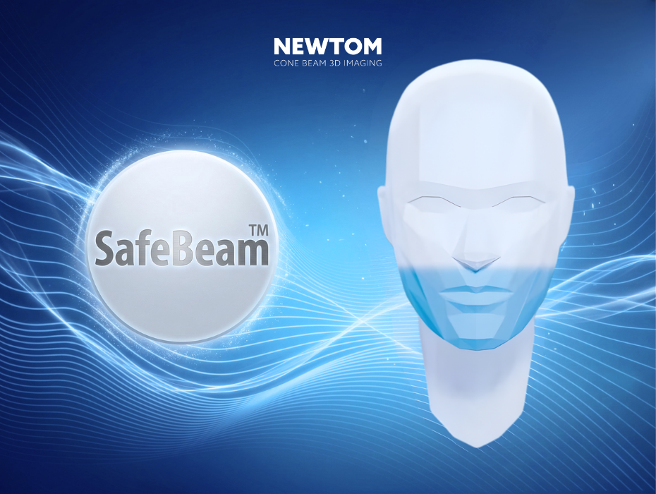 SafeBeam Newtom
