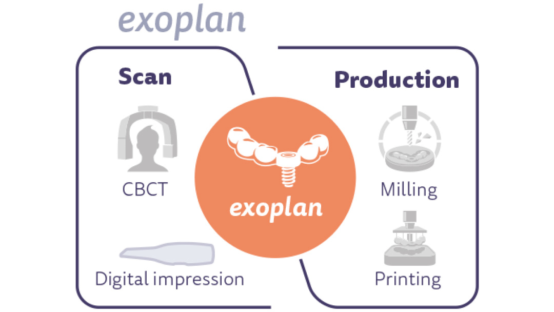 exocad-eng-exoplan