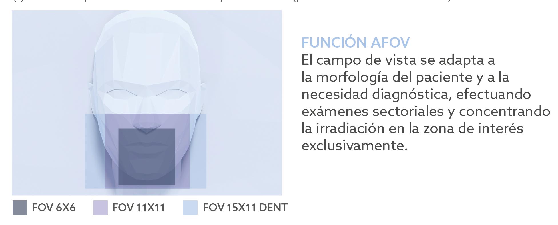 SP FOV VG One