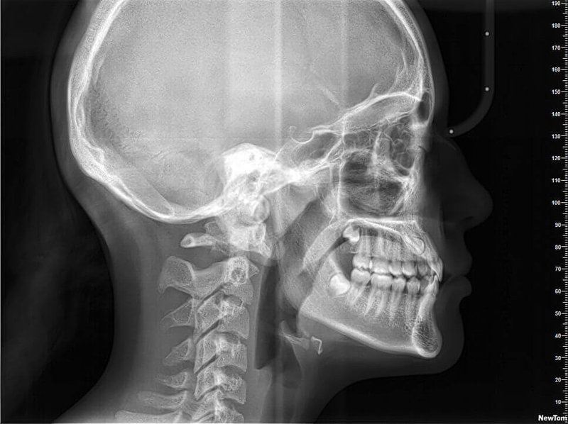 Radiografia Cefalometrica 2D